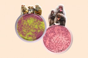 Infectious disease specialists explain the dangers of monkeypox
